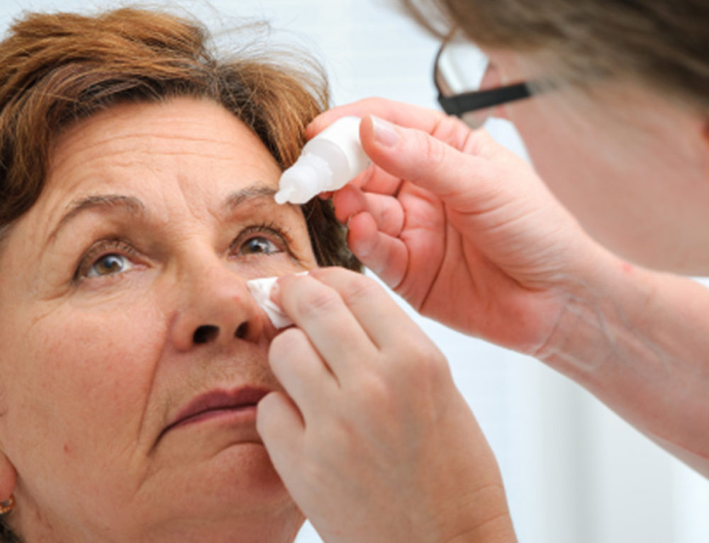 Когда можно мыть голову после катаракты. Закапывая капли в глаза пациенту. Аппликационная терапия глаза. Инстилляция глазных капель.
